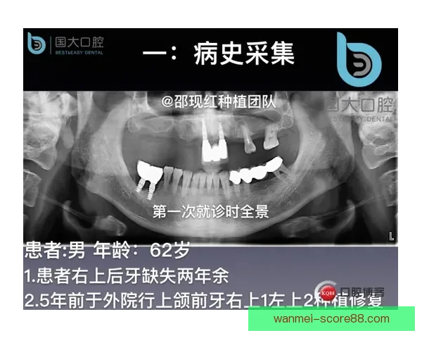 科尔透露穆迪软骨和骨骼无损伤 专家称手术风险较低